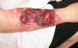 makeup depicting a badly wounded arm